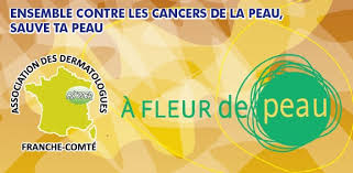 A fleur de peau 